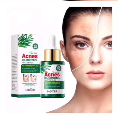 سرم ضدجوش و آکنه و ضدلک سادور30میلSADOR